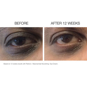 EyeBright Night Cream