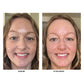 EyeLight- Firming Peptide Eye Cream
