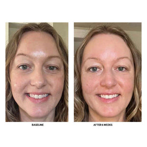 EyeLight- Firming Peptide Eye Cream